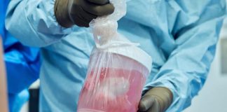 Nir di porko ainda ta funshoná bon despues di transplante