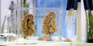 Baimentu atras pashènt ku alzheimer mihó kalkulá