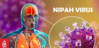 Minister di GMN tin atenshon pa vírus Nipah