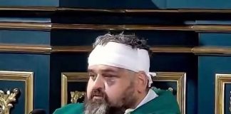 Pordoná esun ku a purba mata mi?